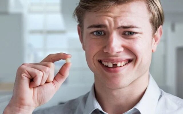 Kiểm chứng hiện tượng rụng răng mang đến ý nghĩa xấu hay tốt